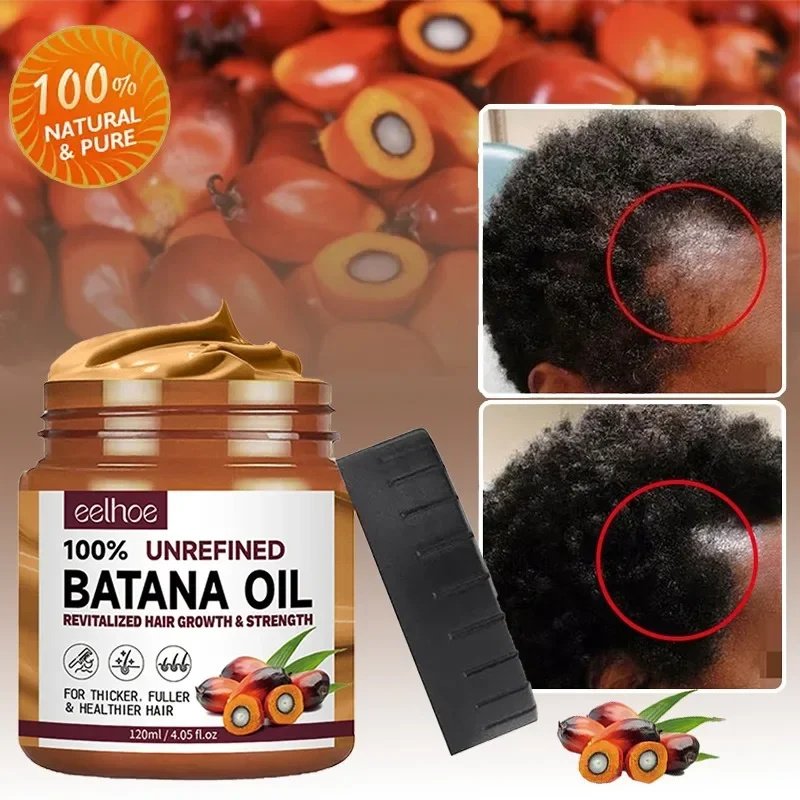 Batana 모발 성장 오일 컨디셔너, 탈모 방지 제품 - Bond Repair Shampoo 리뷰 및 가격