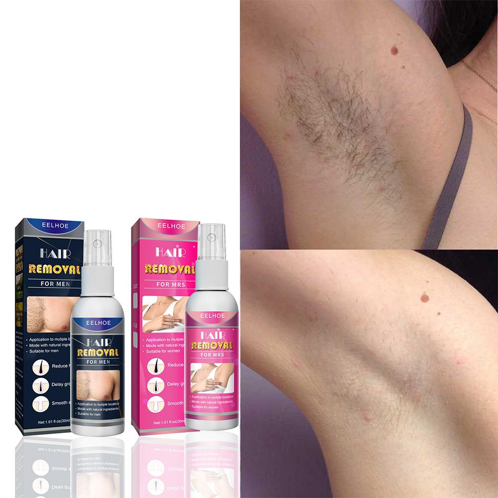 1/2PCS 여성을위한 슈퍼 자연 무통 영구 헤어 리무 - Hair Care Spray 리뷰 및 가격